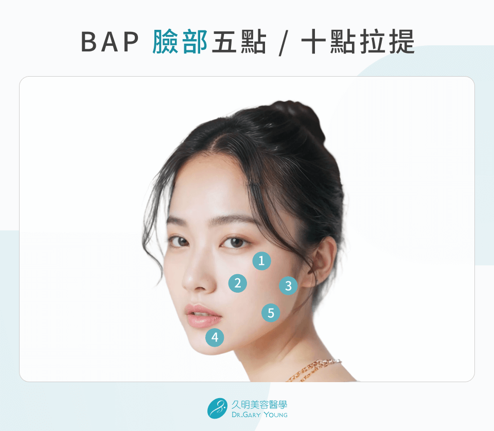BAP 臉部五點/十點拉提