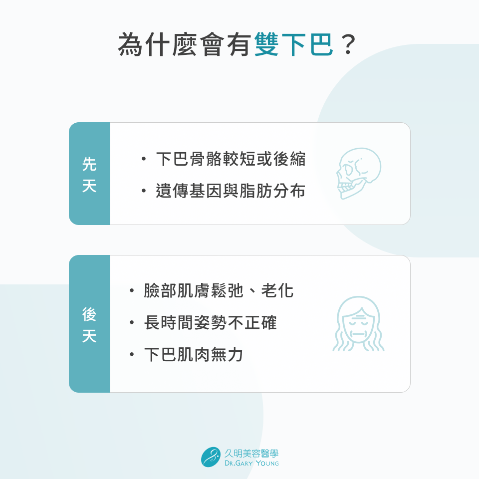 為什麼會有雙下巴？

