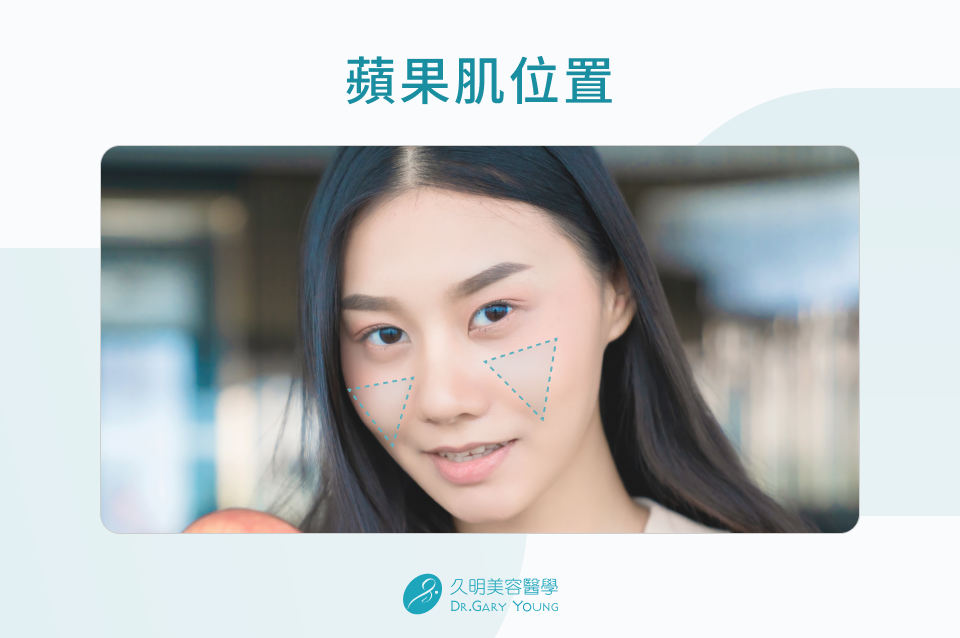 蘋果肌位置