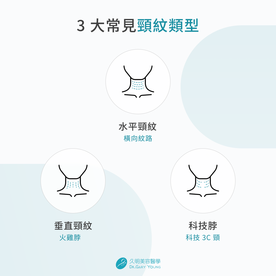 3 大常見頸紋類型