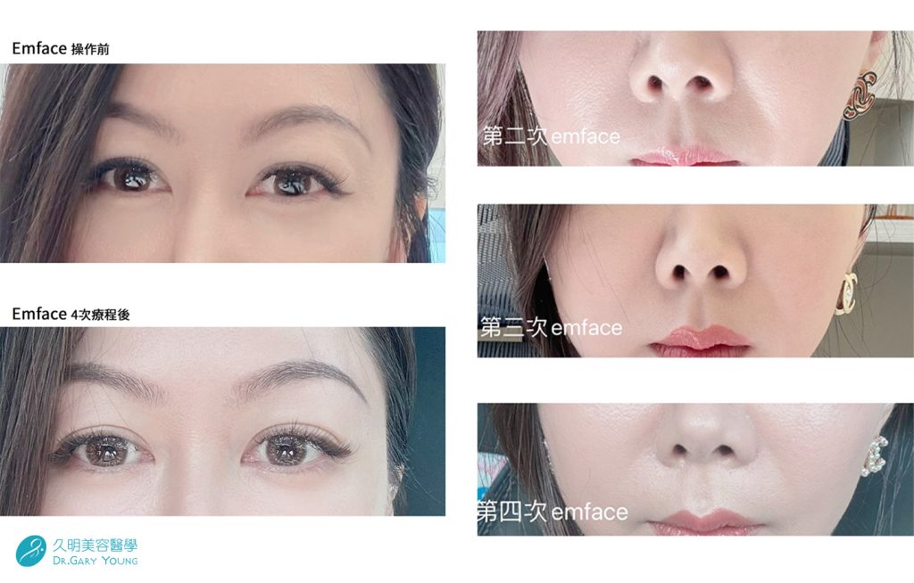 菲斯波案例分享